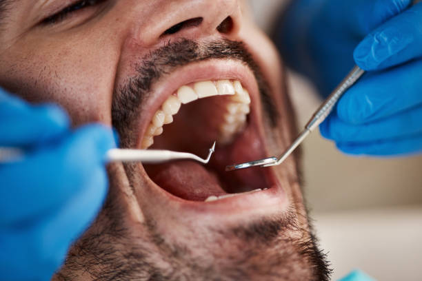 Best Emergency Wisdom Teeth Removal in Monessen, PA