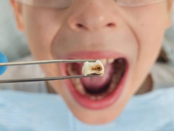 Best Emergency Broken Tooth Repair in Monessen, PA
